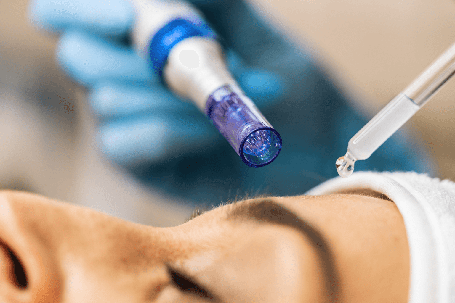 Microneedling